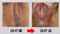 5-141226112G22B.jpg